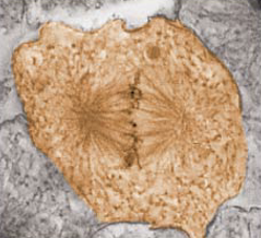 <p>What stage of mitosis is this cell in</p>