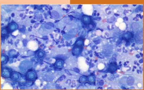 <p>Where is&nbsp;<span style="color: rgb(255, 255, 255);"><span>Blastomyces dermatitidis found </span></span></p>