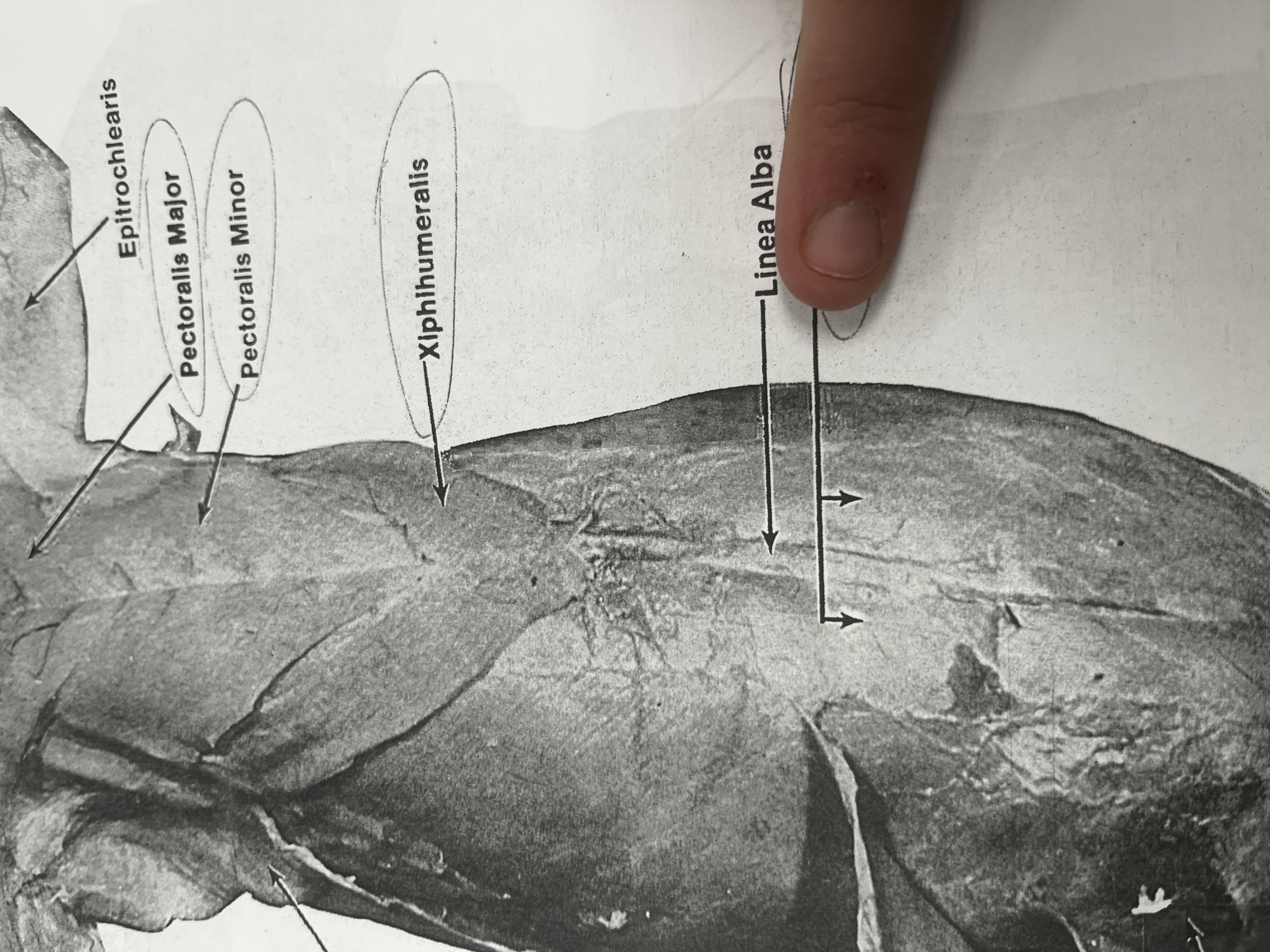 <p>A paired muscle running vertically on each side of the anterior wall of the human abdomen.</p>