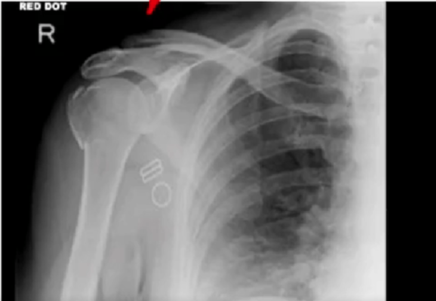 <p>1. What projection is shown in the image?</p><p>2. What are the clinical indications for this projection?</p><p>3. Is this an optimal image?</p><p>4. Name all of the anatomy.</p><p>5. Does this image meet all criteria?</p><p>6. Where is the CR placed?</p><p>7. If applicable, what method is interchangeable with this projection?</p>