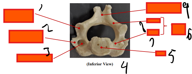 <p>inferior </p>