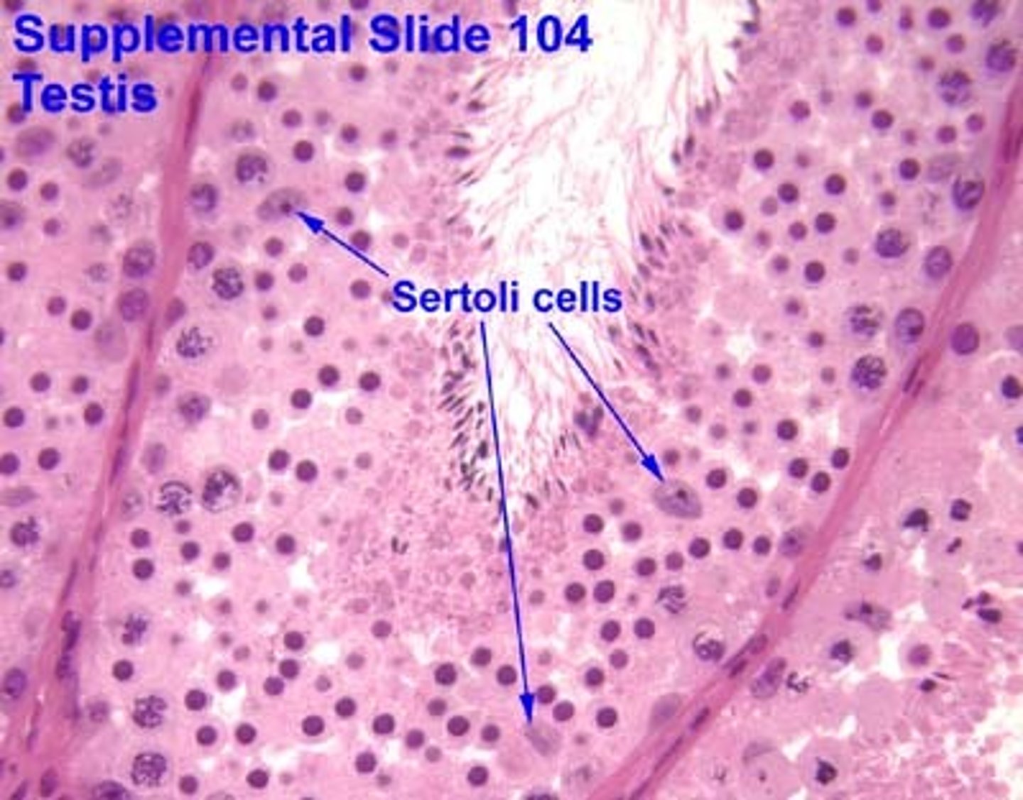 <p>sustentacular (sertoli) cells</p>