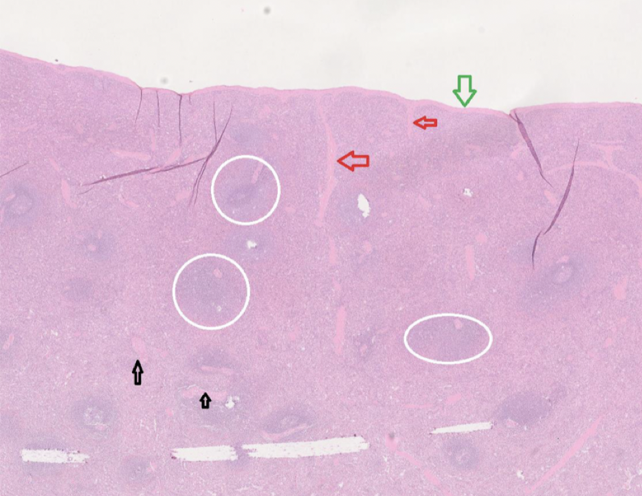 <p><span style="color: green">Grön</span>: Fibrös kapsel.</p><p><span style="color: red">Röd</span>: Trabekler.</p><p>Vit ring: Vit pulpa. </p><p>Svart: Kärl</p>