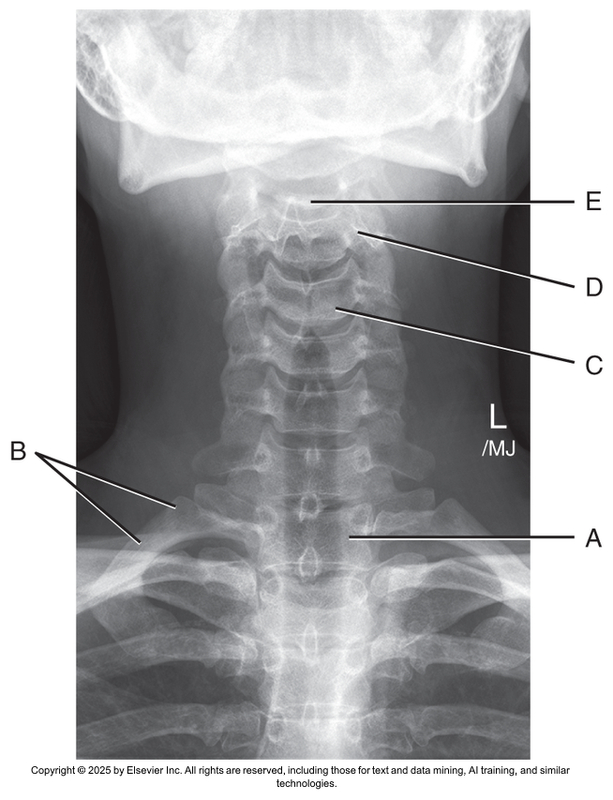 <p>What anatomical structure is letter A?</p>