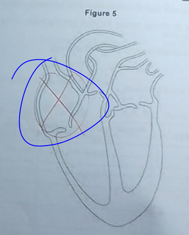 <p>On the  right atrium.</p>