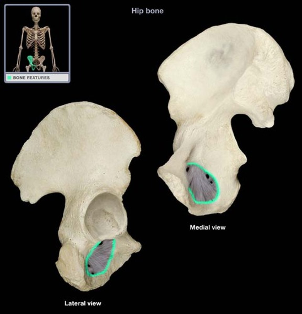 <p>opening in hip bone formed by the pubic and ischial rami</p>