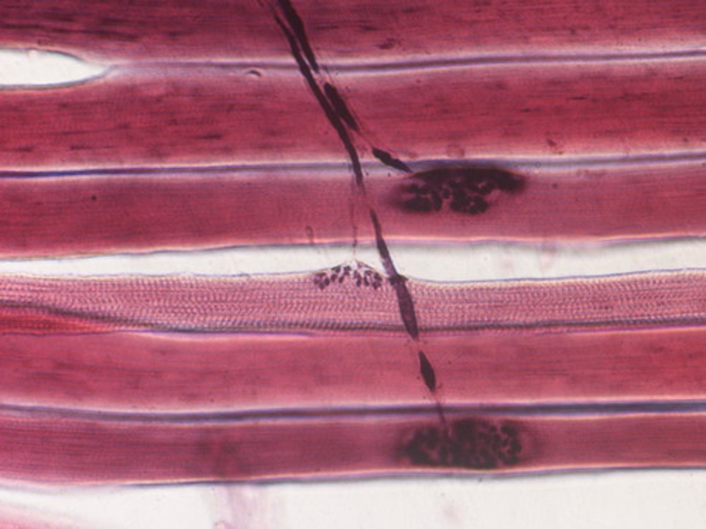 <p>Junction between the axon of a motor neuron and a muscle</p>