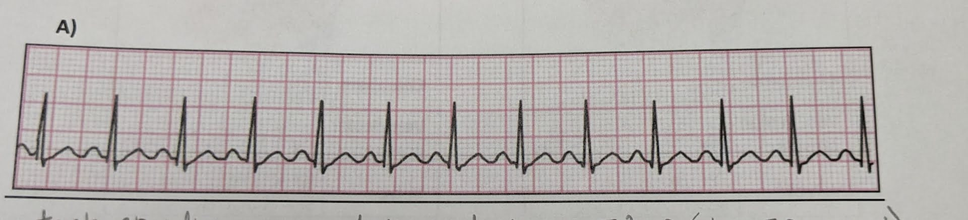 <p>identify the ECG abnormalities (if any)</p>