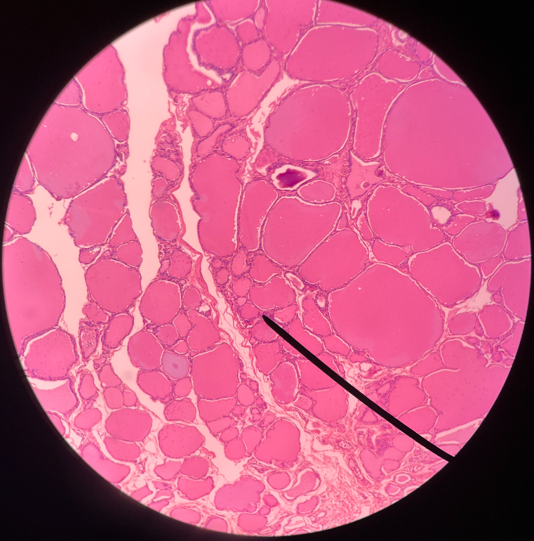 • One of the cells composing a thyroid follicle.

• Secretes thyroxine and triiodothyronine.

• Appears dark when stained.