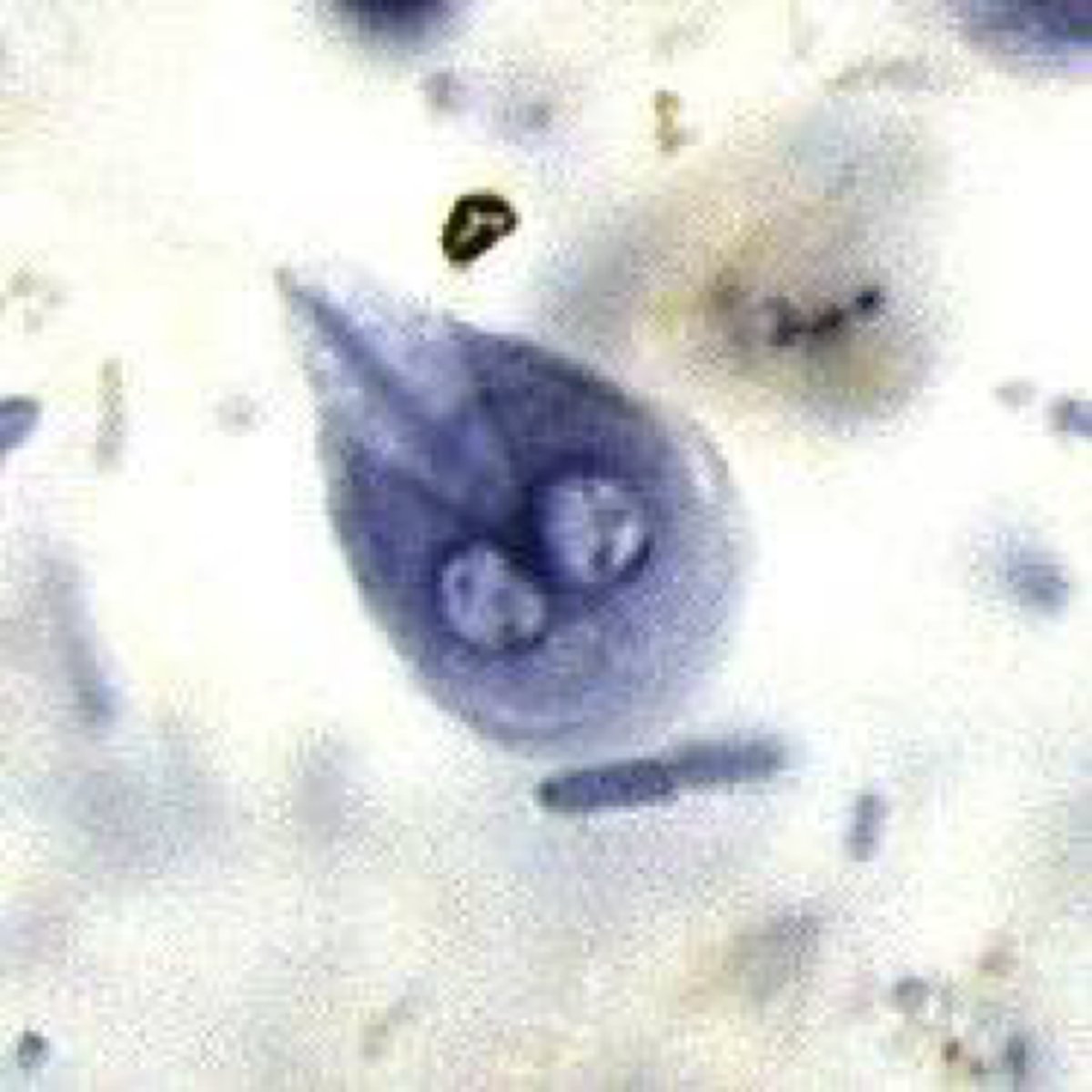 <p>Name the stage and species</p>