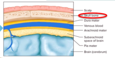 <p>Bone of brain </p>