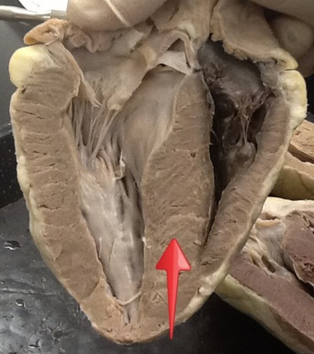 <p>separates ventricles</p>