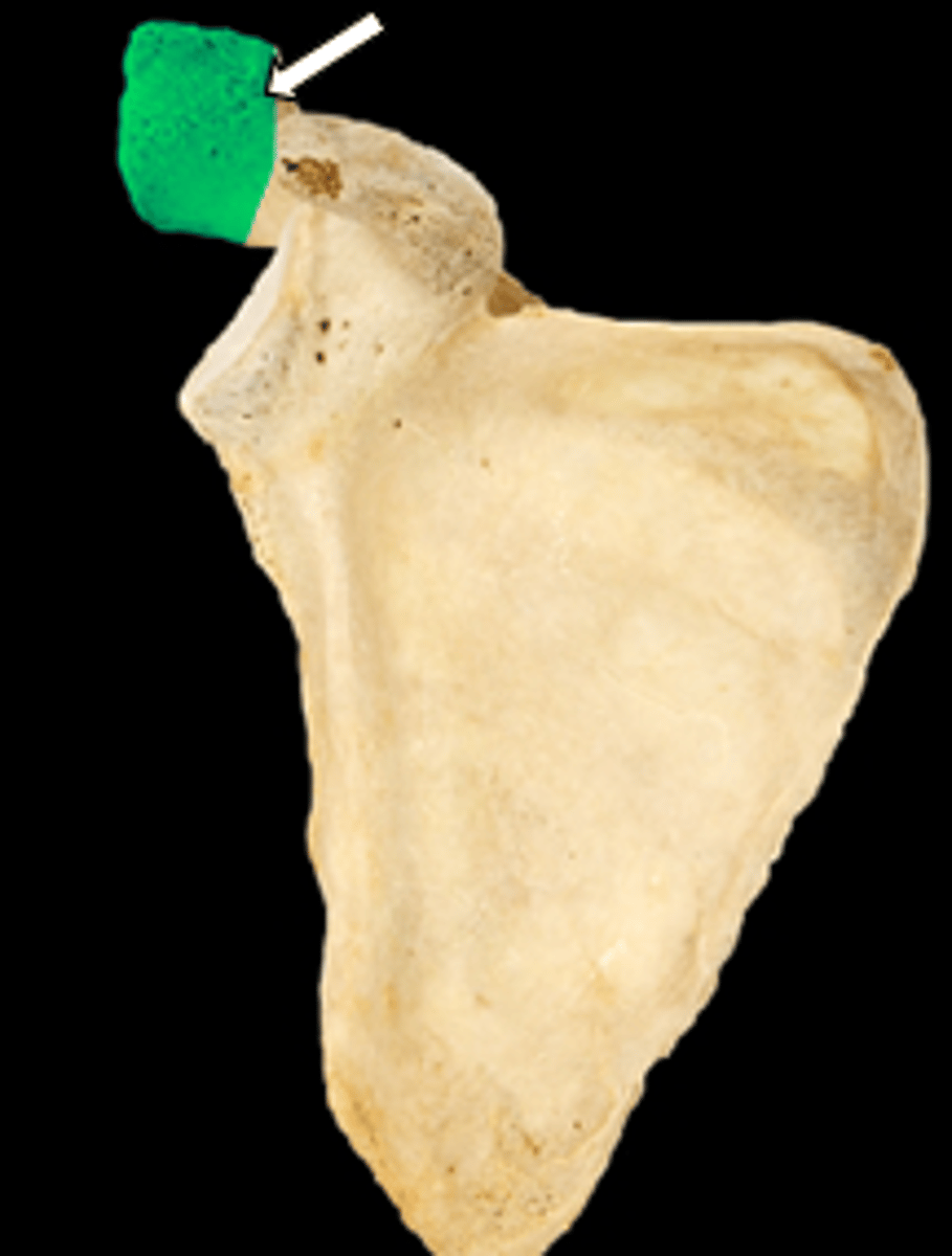<p>name the part</p>