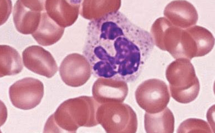 <p>Neutrophils</p>