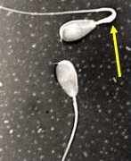 <p>Identify the sperm morphology.</p>