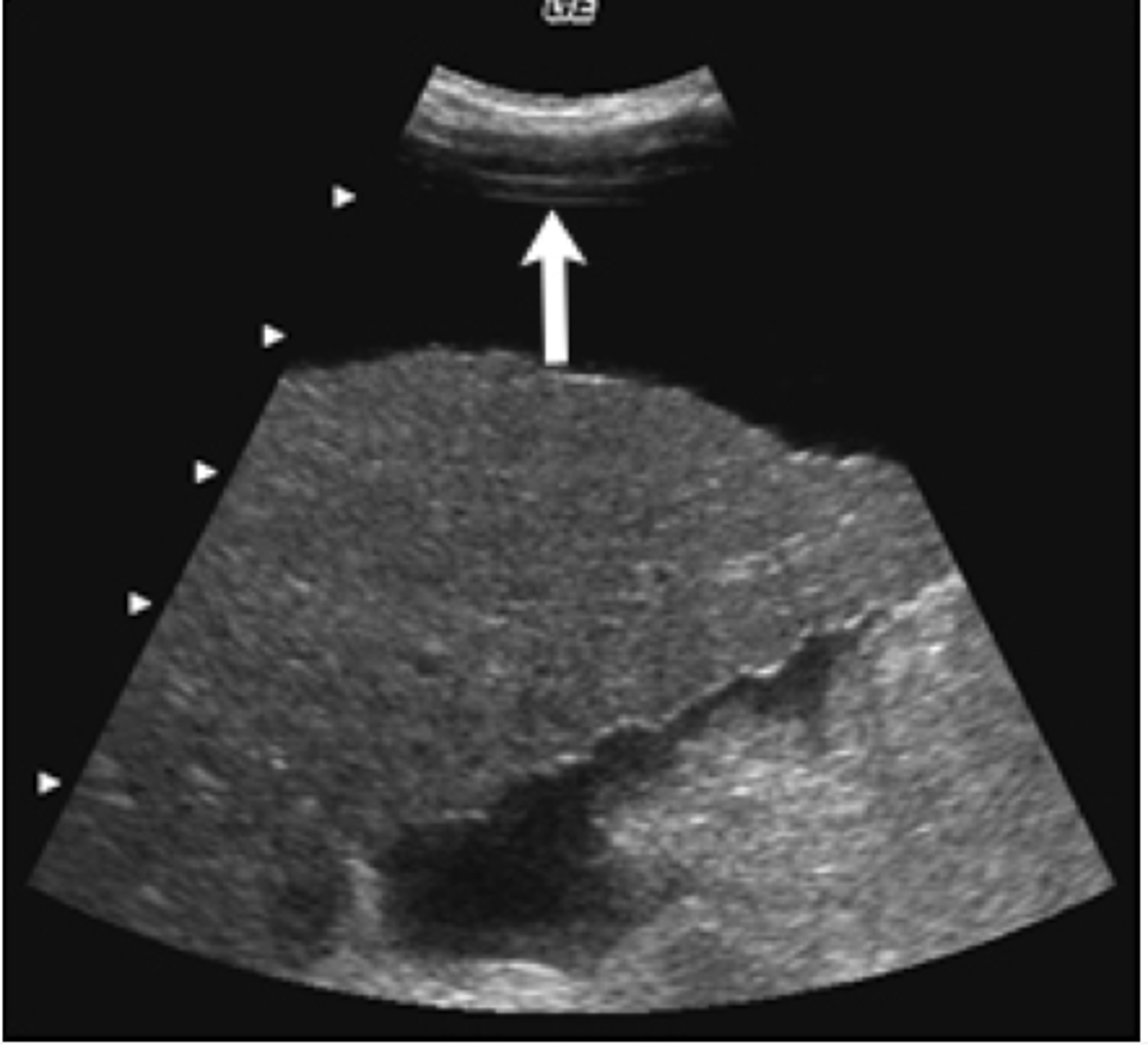 <p>What artifact is this arrow pointing to?</p>