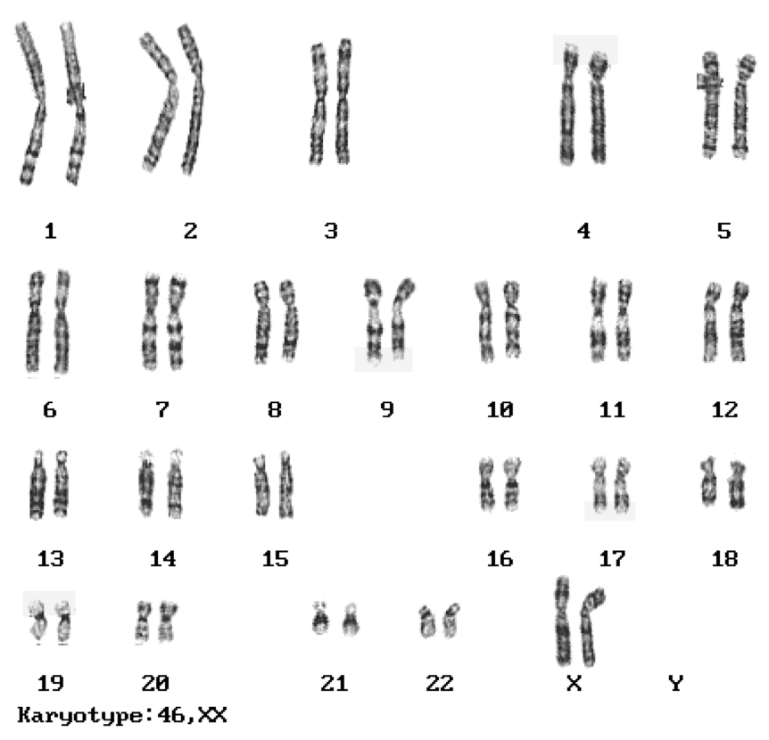 Female karyotype