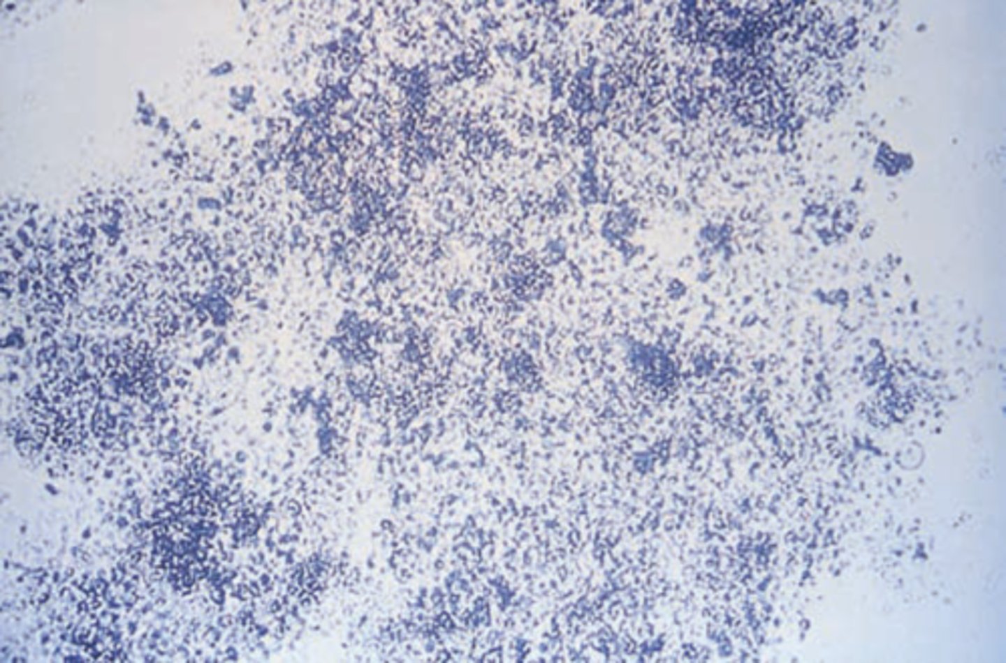 <p>- Similar to amorphous urates<br>- Alkaline pH and heavy white precipitate after refrigeratio</p>