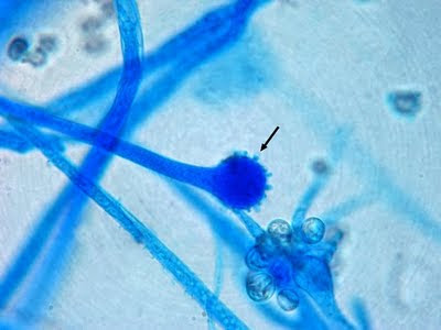 <p>Identify this fungus</p>