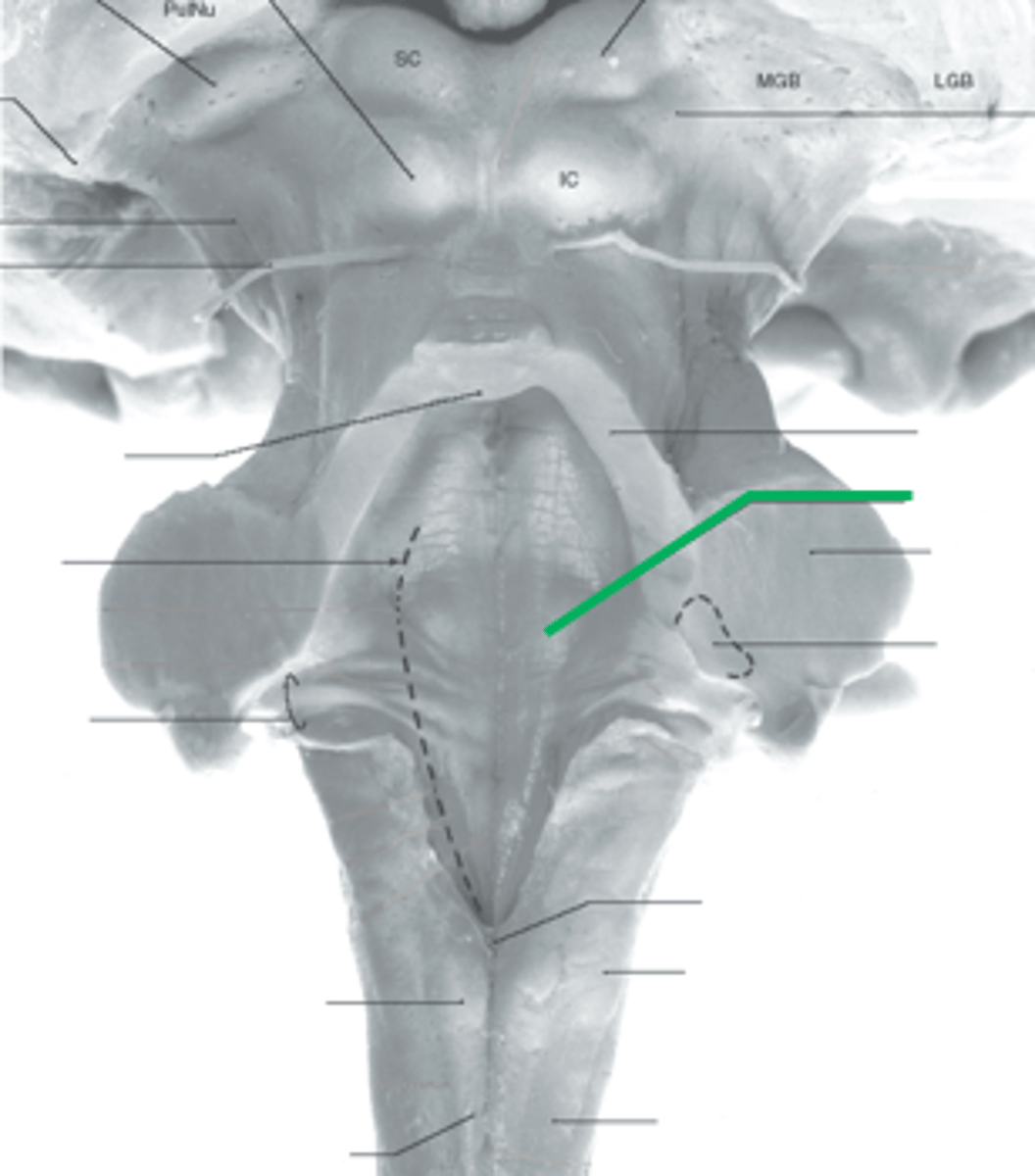 <p>facial colliculus</p>