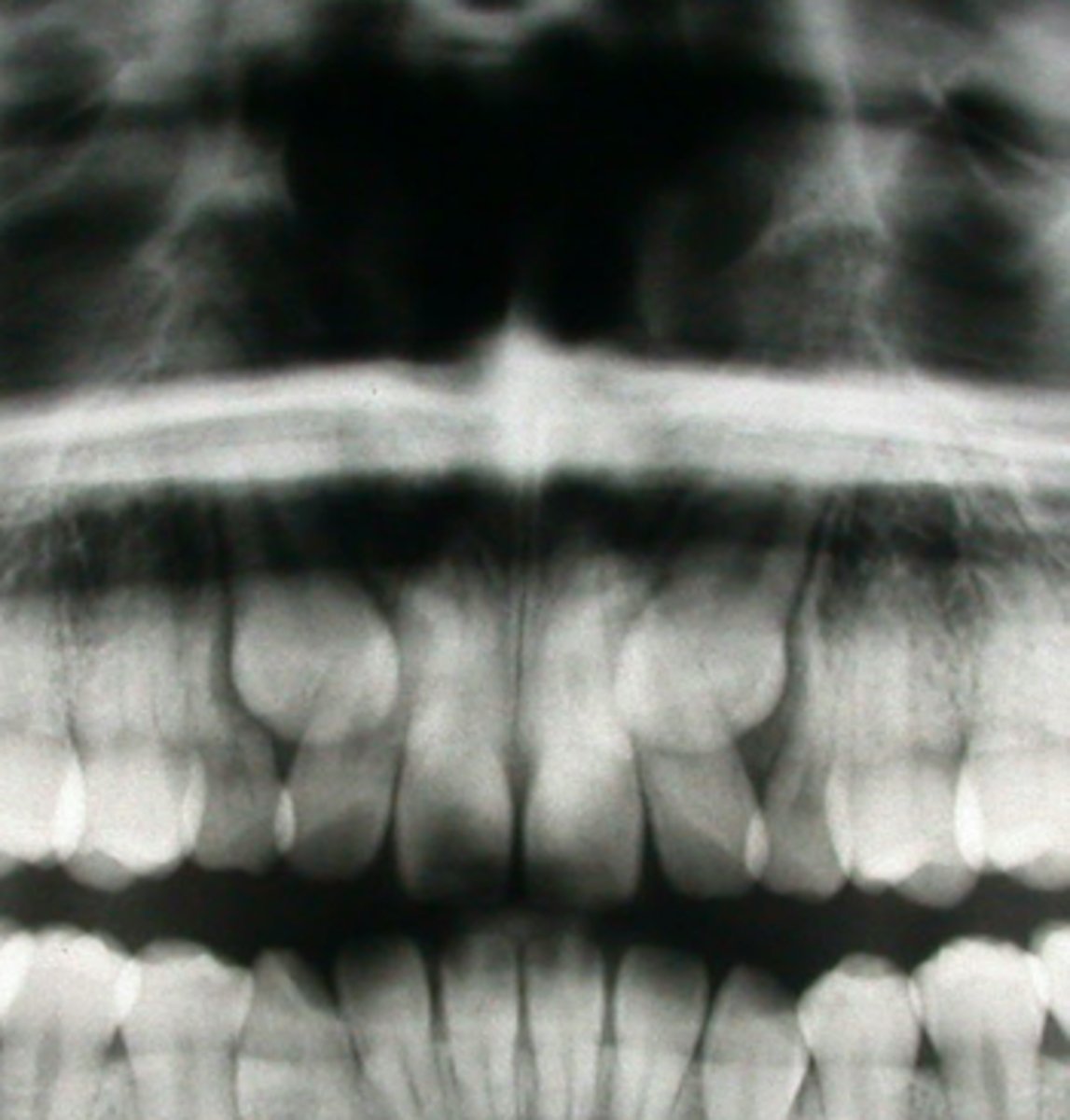 <p>ID the developmental disturbance:</p>