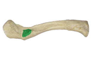 <p>(posterior and  inferior)</p>