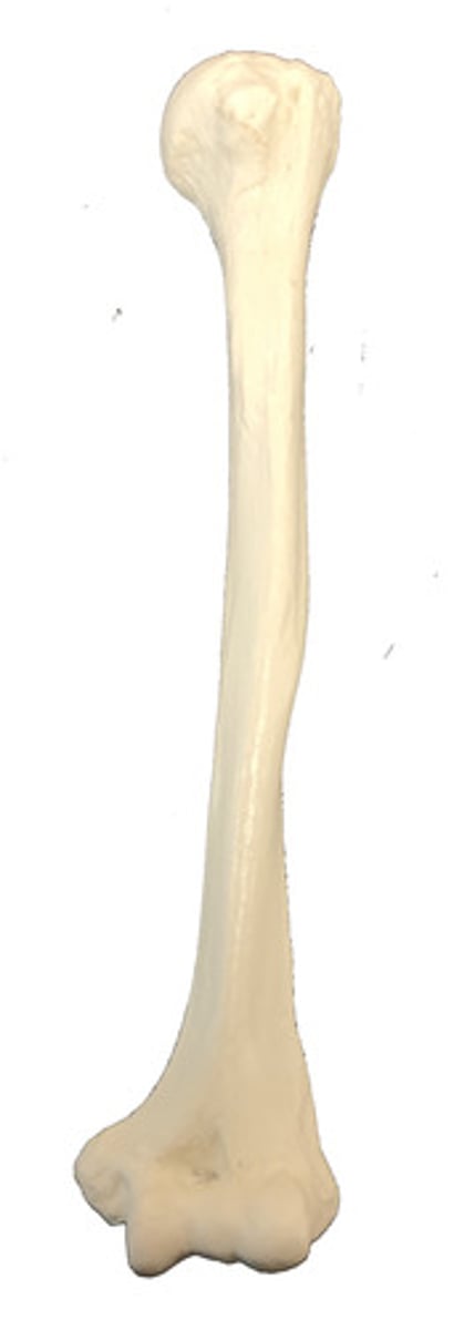<p>Identify this bone.</p>