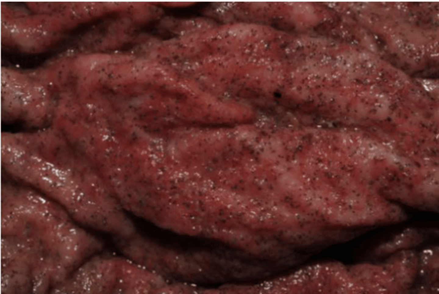 <p>What is this parasite? What characteristic/s did you use to identify it? (LI mucosa)</p>