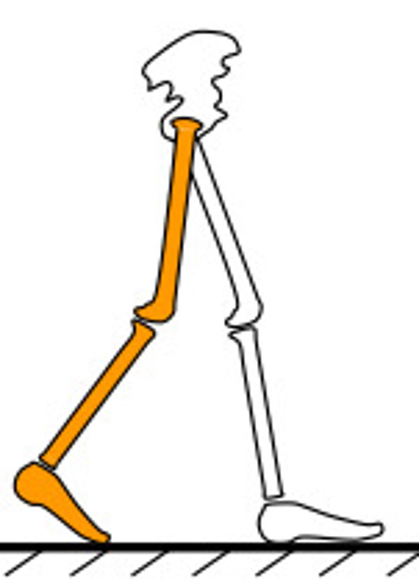 <p>50-60%</p><p>Begins at the beginning of the second double limb support.</p><p>Ends when the toe clears off the ground of the reference limb.</p><p>Important for getting the reference limb into a "Trailing Limb Posture". This is an important position to begin the sudden change in direction of lower extremity flexion for early swing phase of gait.</p>