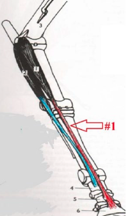 <p>What is this muscle? What joints does it move? Where does it originate and insert? (1)</p>