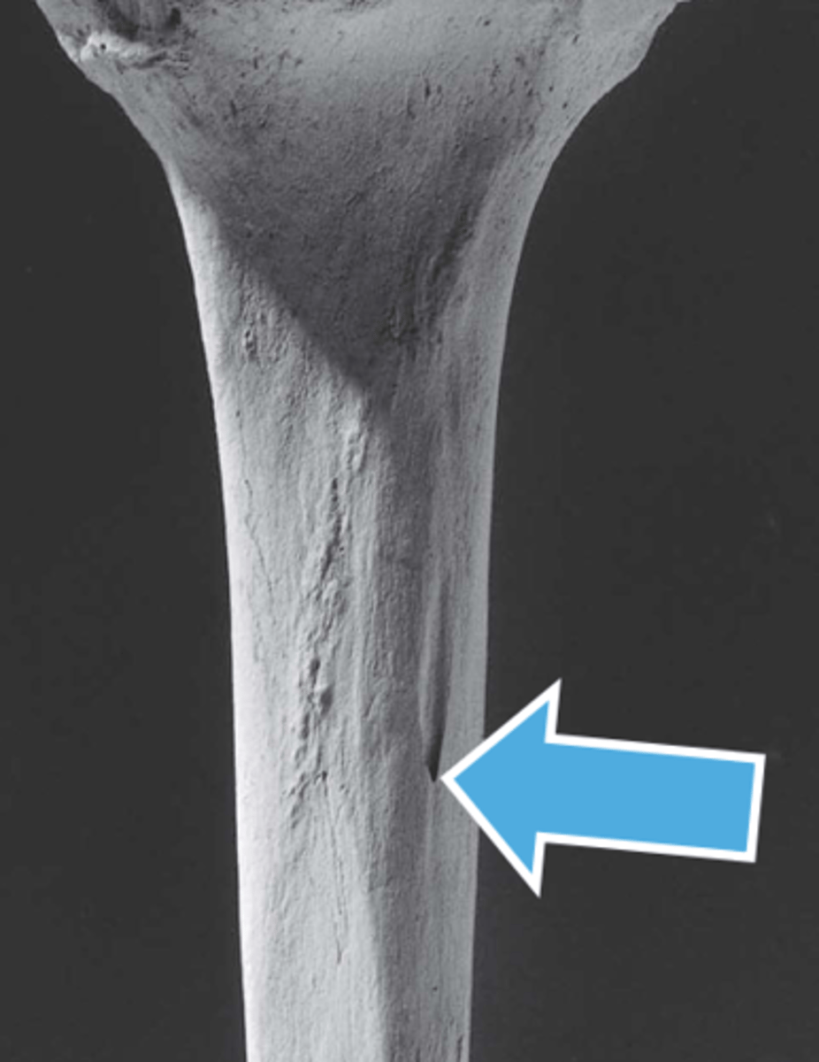 <p>Small hole on the posterior side of the Tibia, about 1/3 down the shaft</p>