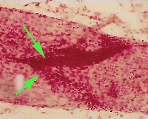 <p><span>The structure labeled by the green arrows is a <strong>valve</strong> found in a lymphatic vessel.</span></p>