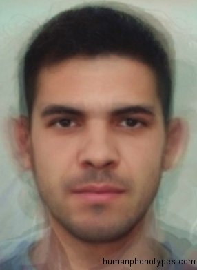 <p>Identify this Phenotype</p>
