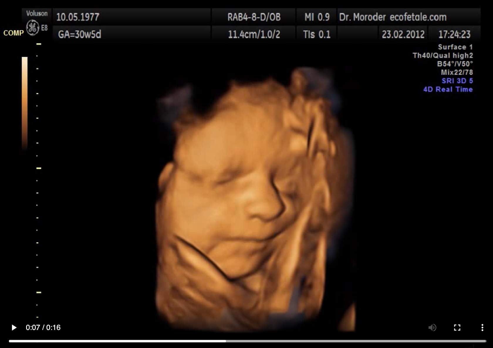 <p>What are <strong>ultrasound machines? What do they do?</strong></p>