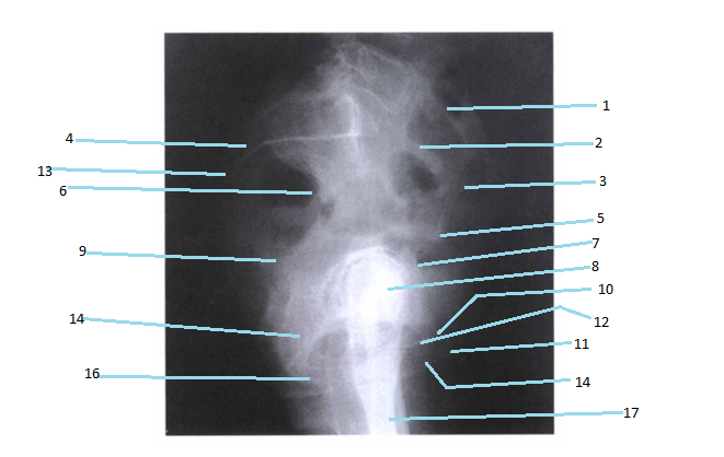 <p>11</p>