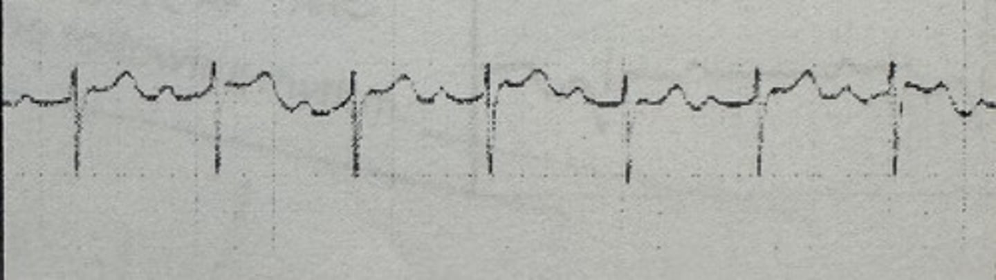 <p>identify the rhythm</p>