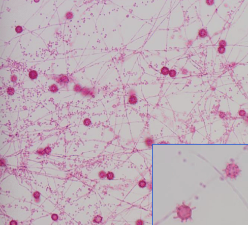<p>Histoplasma Capsulatum</p>