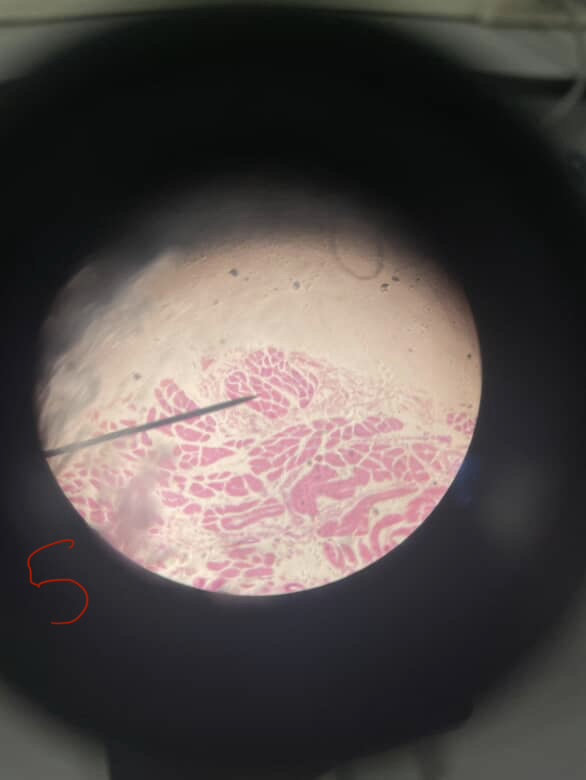 <p>Name the Muscle</p>