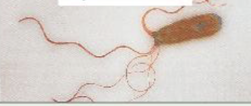<p>What type of Flagella arrangement is this?</p>