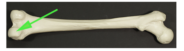 <p>What is the irregularly shaped surface of the femur, shown by the green arrow?</p>