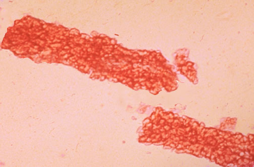 <ol><li><p>Identify structure.</p></li><li><p>What disease is this structure primarily associated with?</p></li></ol><p></p>