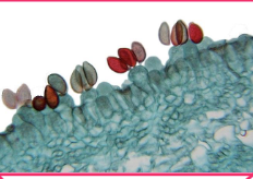 <p>Sexual spore of Basidiomycota (club shaped)</p>