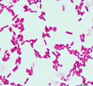<p>Which is type of microscope is this? (E.coli under microscope) </p>
