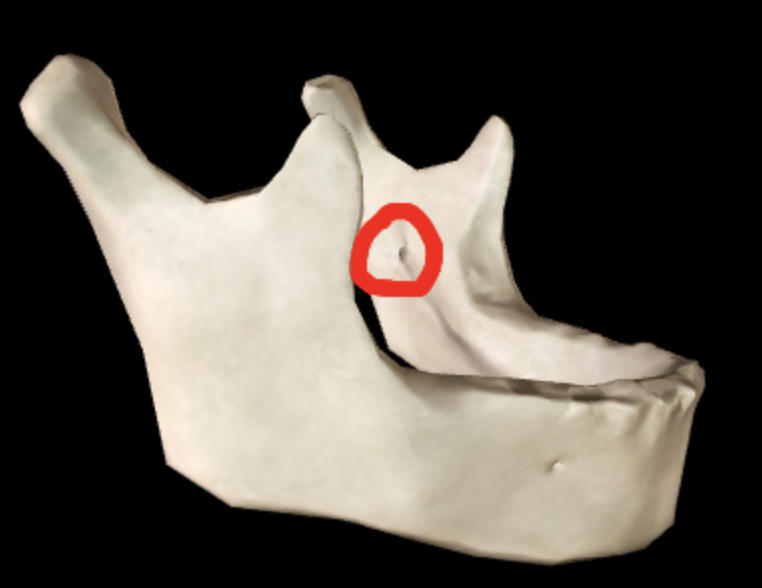 <p>What part of the mandible is this?</p>