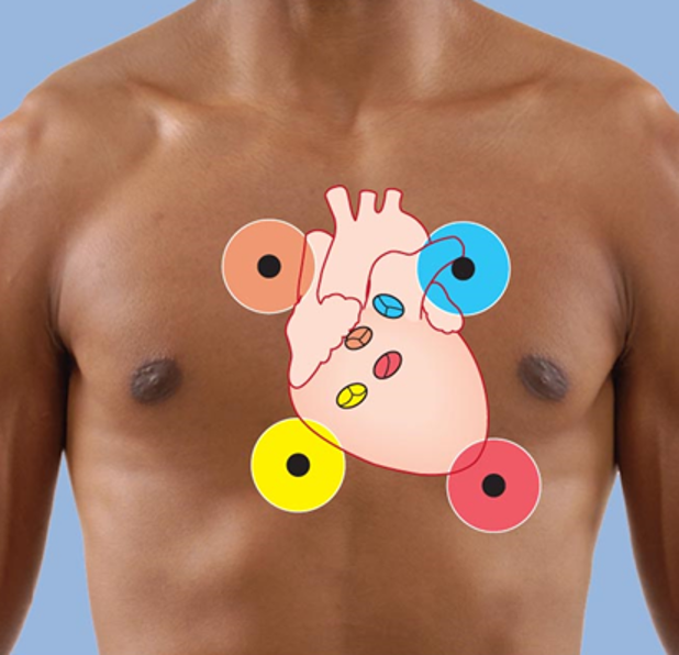 <p> red circle area (mitral area) / left mid-clavicle line down to 5th rib </p>