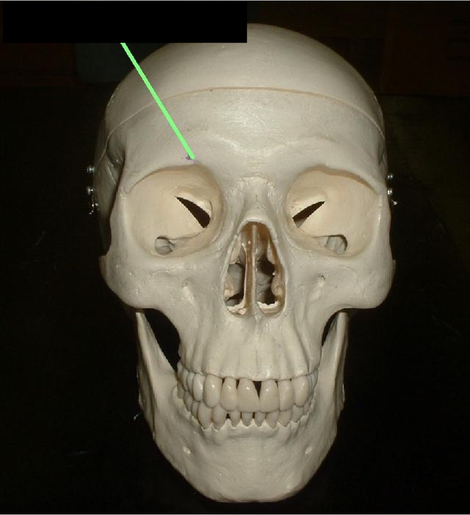 <p>above the eye socket; a hole that is usually circular.</p>