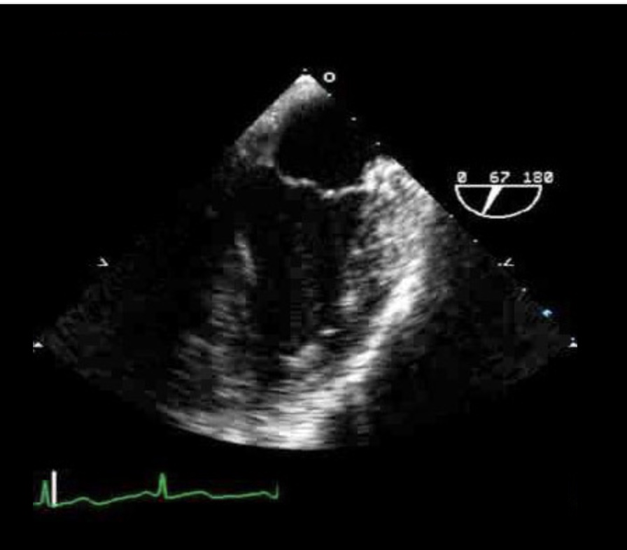 <p>What TEE view is this? ID the structures</p>
