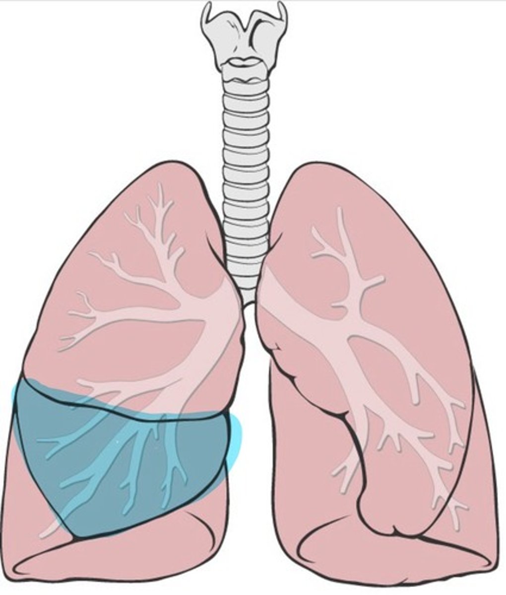 <p>Middle lobe of the right lung</p>