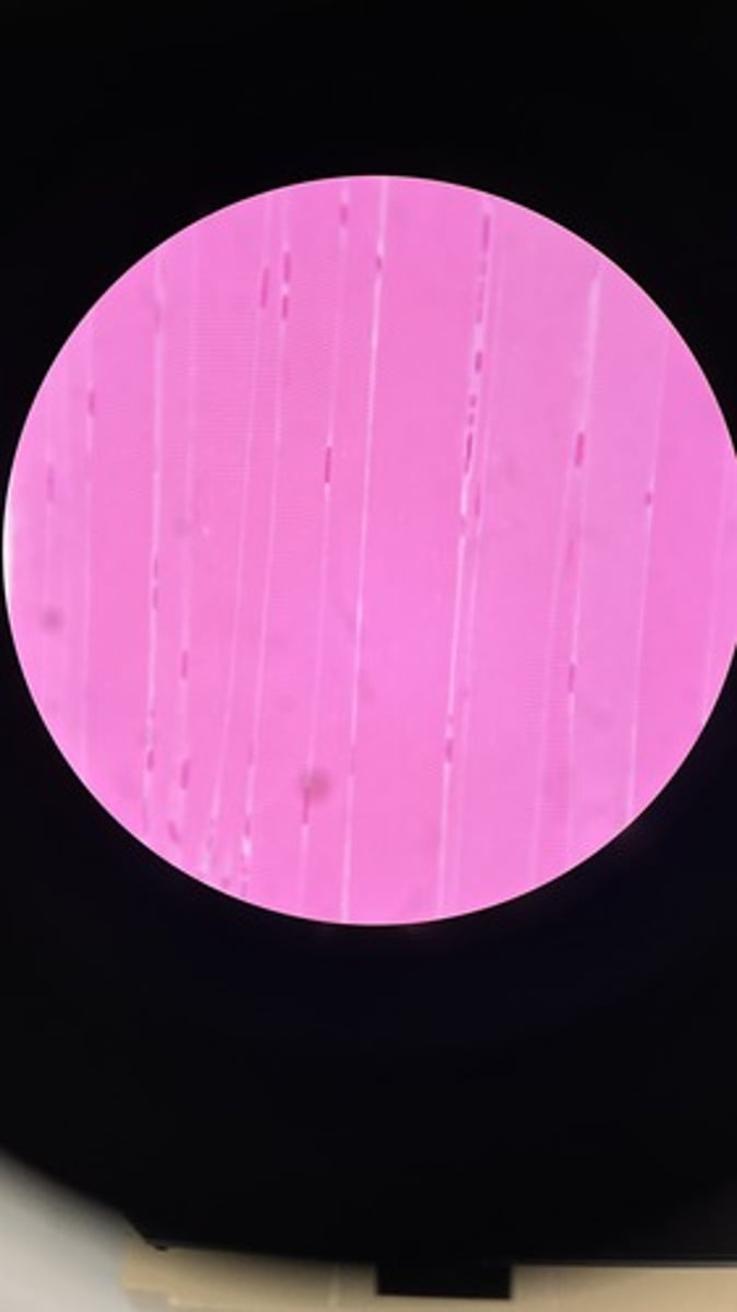 <p>Voluntary muscle attached to bones.</p>