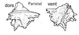 <p>A bone located on the top and sides of the skull.</p>